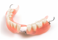 Tháo lắp nhựa cứng